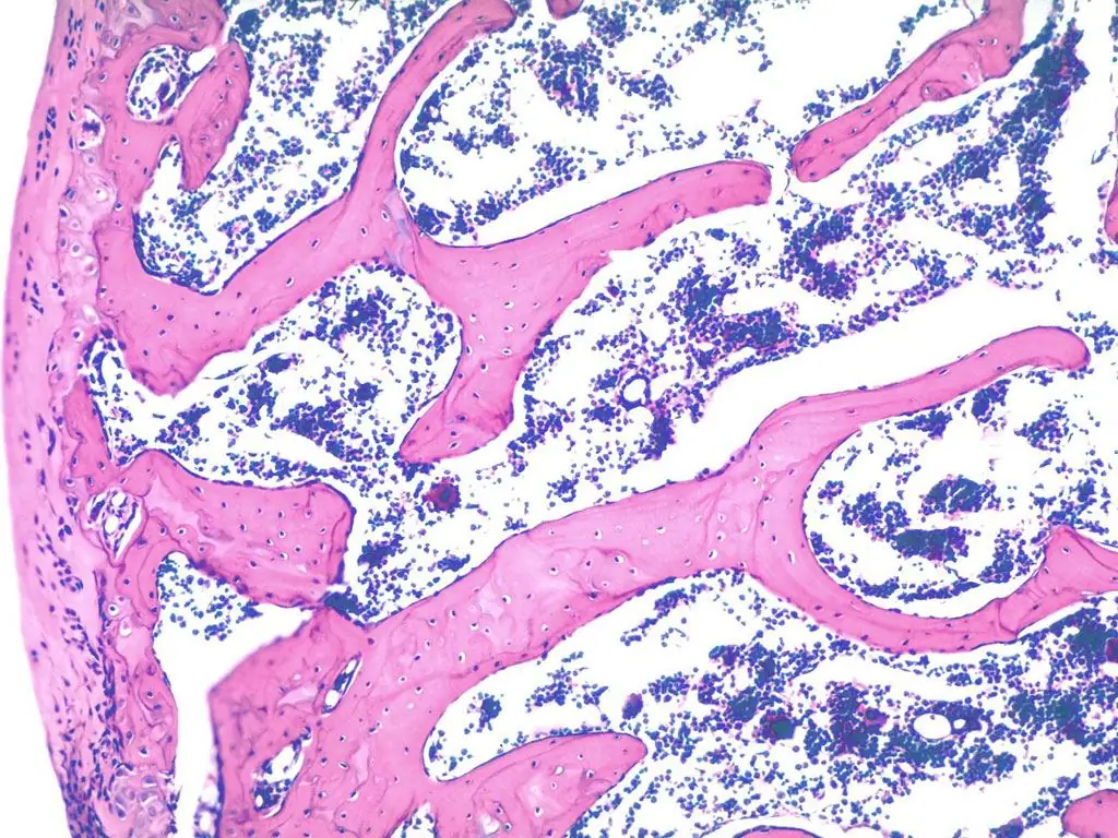 elements of bone tissue