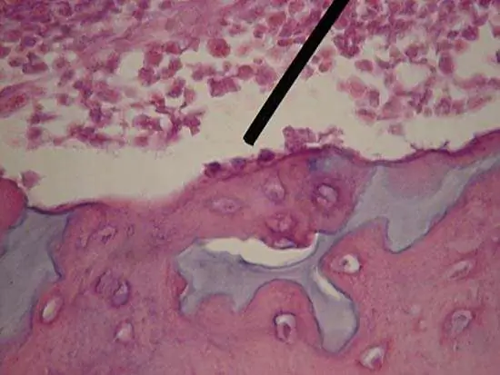 osteoblast v kosti