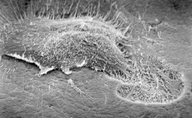osteoblast cell osteoblast cell